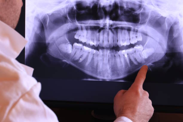 Best Emergency Root Canal Therapy in Mountain Park, GA