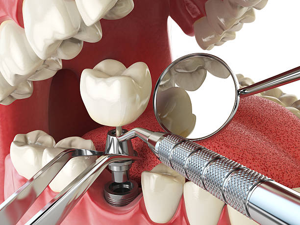 Best 24-Hour Emergency Dental Care in Mountain Park, GA